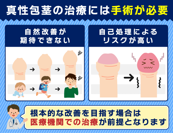 真性包茎の治療に手術が必要な理由についての列挙型画像