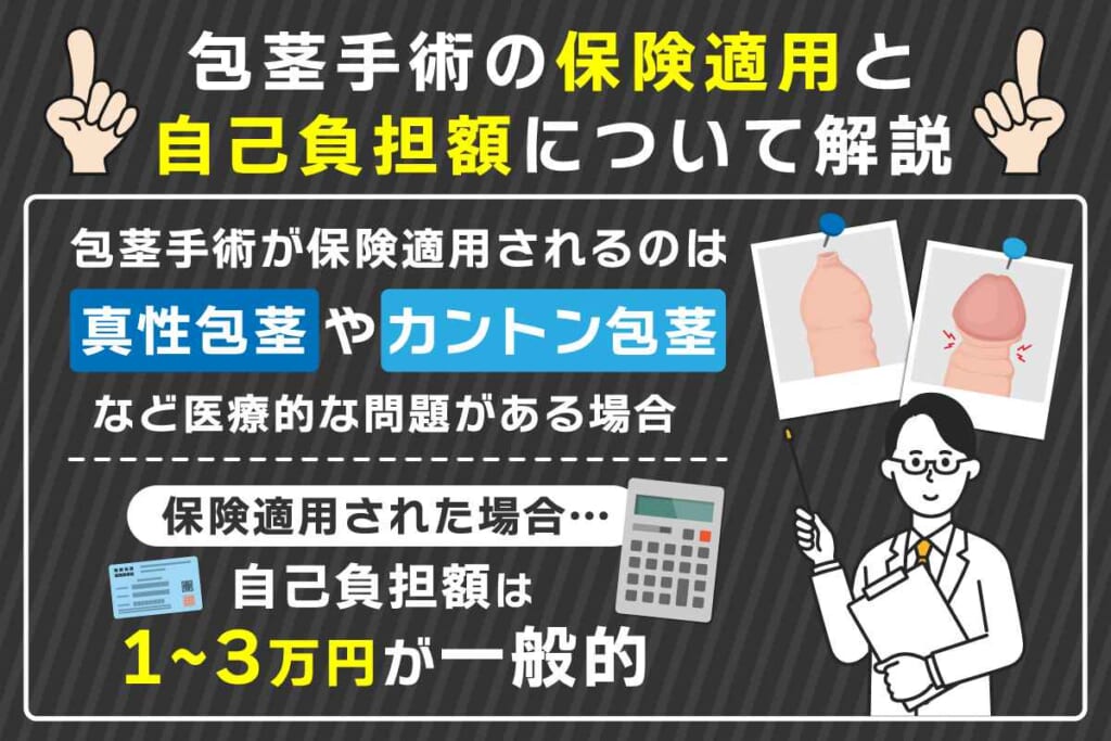 包茎手術の費用相場を種類別に解説