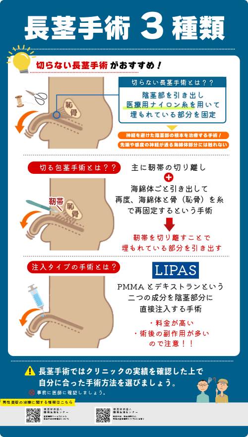 長茎手術の方法3種類「切らない長茎手術・切る長茎手術・注入タイプの長茎手術」を解説する画像