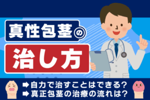 真性包茎の治し方とは？自力で治すことは基本的にできない理由と治療の流れについて解説