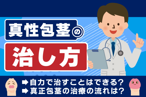 真性包茎の治し方とは？自力で治すことは基本的にできない理由と治療の流れについて解説