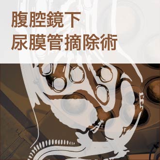 腹腔鏡下尿膜管摘除術