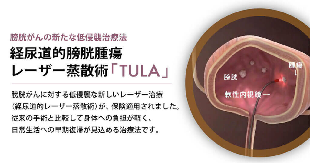 Cross-sectional diagram of the vaginal canal showing a flexible endoscope guiding a laser probe to a labeled tumor (腫瘍) inside, illustrating a new low-invasive laser therapy (TULA).